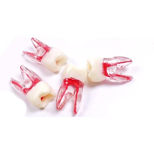 Dental Tooth Endo Root Canal Study Model For RCT Practice Block Pulp Cavity