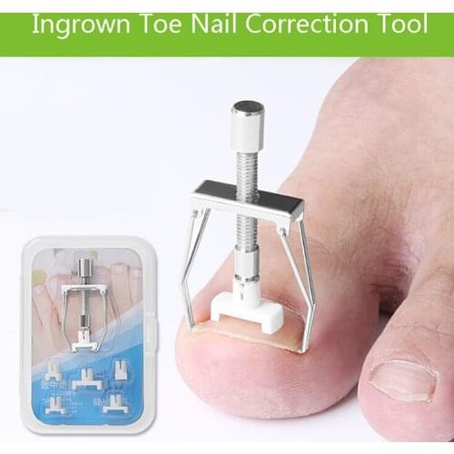 1 Set Ingrown Toenail Correction Tool Nail Corrector Tool Kit Toe Paronychia Nail Brace Pedicure Care Tool Hot