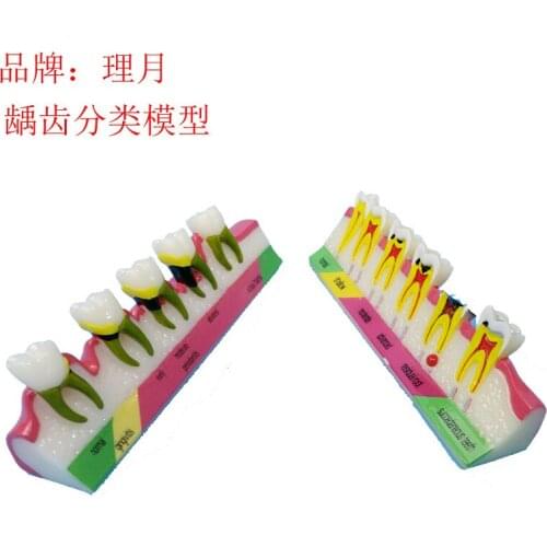 Colored Human Oral Teeth Model Periodontal Disease Model Teeth Pathology Model Medical Teaching Aids Dentist Teaching Equipment