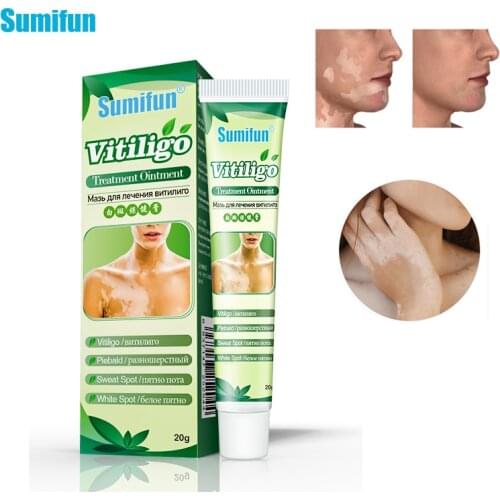 1Pc White Spot Ointment Antibacterial Cream Localized Mycosis Leukoplakia Plaster Vitiligo Treatment Antibacterial Oil Skin Care