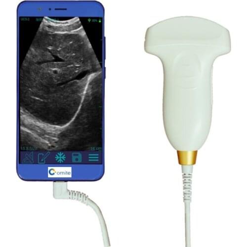 128 Elements Wifi Medical Portable Ultrasound Usb Usg Wireless Ultrasound Probe Price For Ios Android