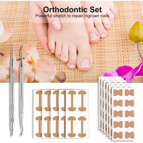Anti-pain 1 Set Effective Toe Nail Corrector Tools Kit Manicure Toenail Correction Patch Breathable for Adults