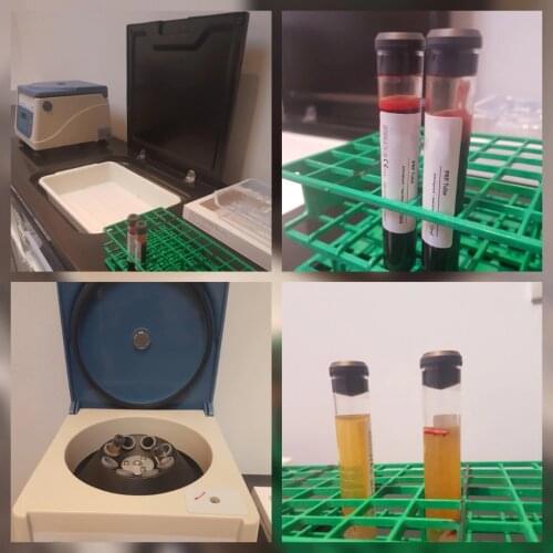 Popular PRP Centrifuge for 10pcs PRP kit 8ml 10ml 12ml 15ml ACD GEL tube for Hair facial skin care beauty dental treatment