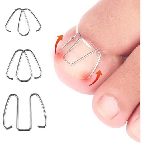 3Pairs Front Nail Hook/rubber Band Nail Art Ingrown Toe Nail Correction Toenail Nail Ingrown Clip Orthosis Paronychia Pedicure