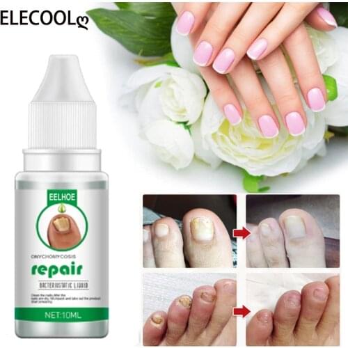 ELECOOL Nail Repair Essenc Serum Anti Fungal Nail Treatmen Remove Onychomycosis Nourishing Brighten Hand Foot Toes Nail Care