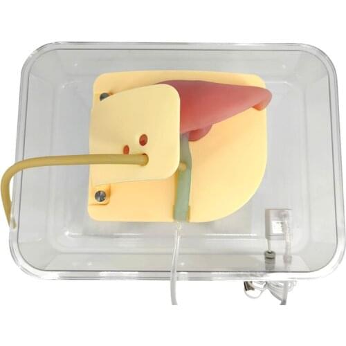 Choledochoscopy training model Hepatobiliary model t type Stone fetching training model