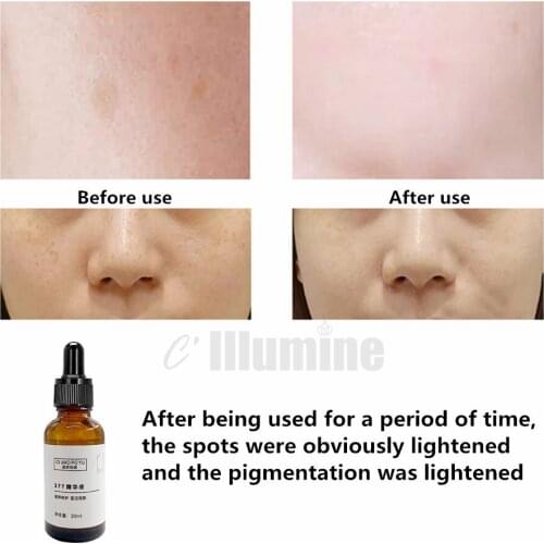 Luminous VC Nicotinamide Whitening Skin Lightening Spots Acne Freckles Moisturizing Repairing Skin Care Serum 30ml