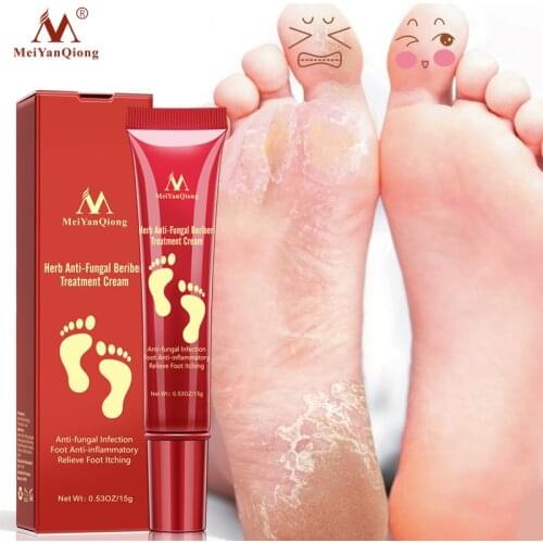 Herbal Foot Cream Anti Dry Crack Moisturizing Feet Care Anti Fungal Infection Onychomycosis Athletes Foot Antibacterial Cream