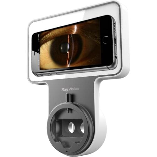 China hot sale ophthalmic instrument digital slit lamp imaging system