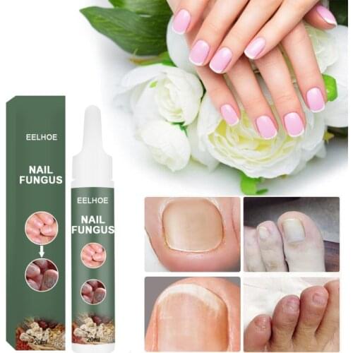 20ml Nail Repair Liquid Onychomycosis Care Painless Removal Of Foot Fungus And Relief Onychomycosis Nail Care Products TSLM1