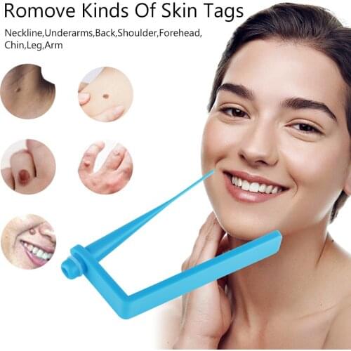 Skin tags remover remove warts body skin care tools spot wart treatment face Skin Tag Removal Tool Acne Remover