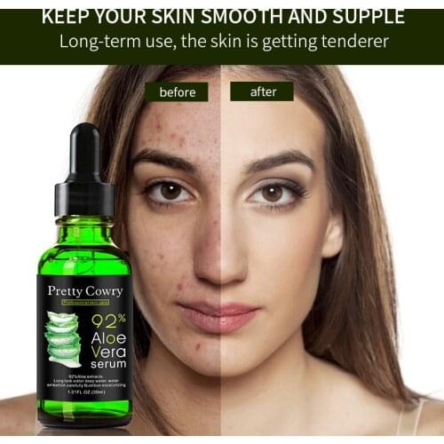 Face Care Acne Scar Removal Essence Serum Acne Spots Skin Care Treatment Whitening Remove Acne Face Serums Care