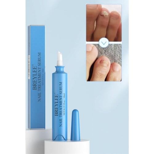 3/10ML Nail Repair Pen Antifungal Gel With Brush Laser Ingredients Removal Foot Fungus Onychomycosis Repair For Nails Manicure