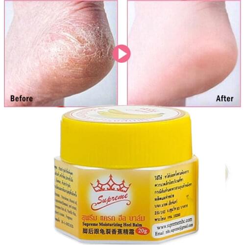 Foot Cream Anti-cracking Moisturizing Brighten Anti-drying Anti-Aging Cracked Feet Banana Peel Extract Vitamin E Foot Care 20g