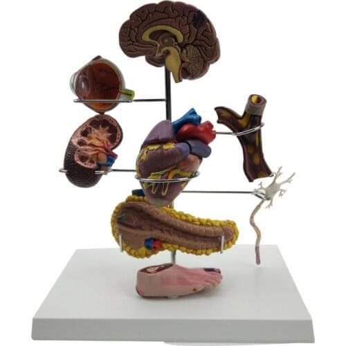 Diabetes Anatomical Model Medical student practice equipment medical laboratory supplies
