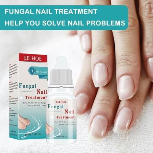 36pcs/box Mosquito Repellent Patch Summer Cartoon Non-woven Plant Essential Oil Anti-mosquito Patches Keeps Insects Far Away New