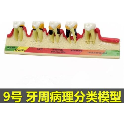 Dental Periodontal Disease Assort Tooth Typodont Model 1pc