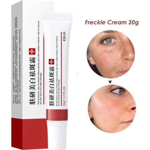 Acne Removal Cream Oil Control Acne Fade Acne Spots Shrink Pores Whitening Moisturizing Skin Care Effective Acne Removal Cream