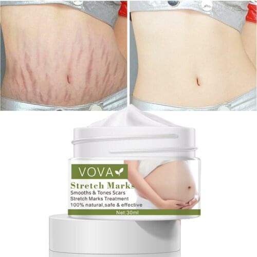 VOVA Repair Scar Cream Skin Care Body Cream Stretch Marks Repair Cream Removal Scar Marks Pregnancy Cream Fade Scald Scar Striae