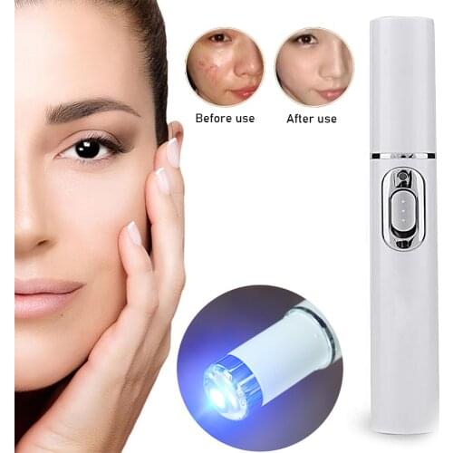 Acne Spots Removal Laser Pen Blue Light Therapy Treatment Laser Pen Soft Scar Wrinkle Removal Treatment Skin Care Tools
