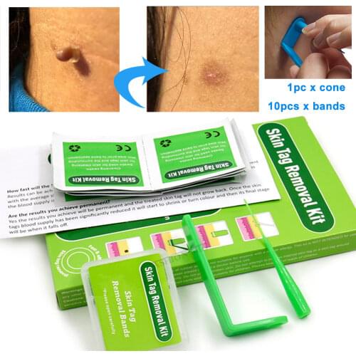 Micro skin tag remover remover patch remover Kit Remove Acne Pimple Blemish Treatments Cleansing Swabs Face Skin Care Beauty