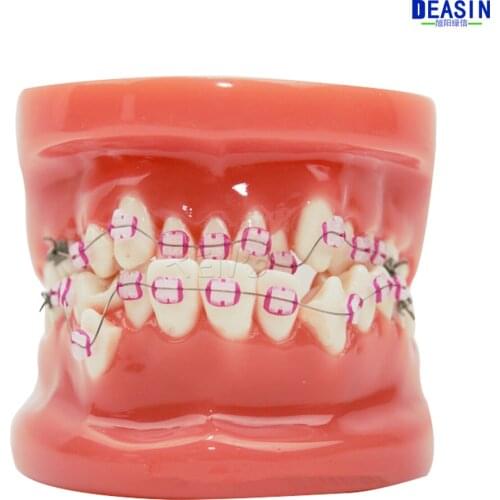 Good Quality 2016 New 1 Piece dental tooth Orthodontists model Malocclusion models Teaching model