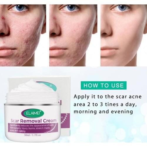 50ml Scar Removal Cream Moisturizing Stretch Marks Relief Scars Acne Cream Repair Burns Repair Acne Mark Removal Cream
