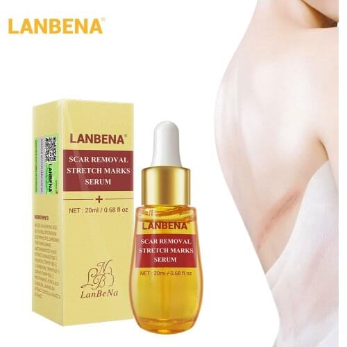 LANBENA Acne Scar Remove Serum Acne Treatment Remover Stretch Marks Anti Acne Shrink Pores Blackhead Whitening Cream Skin Care