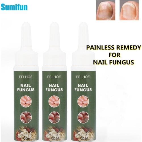 1pc Finger Toe Onychomycosis Treatment Cream Fungal Nail Repair Plaster Herbal Fungus Removal Ointment Anti Infection Paronychia