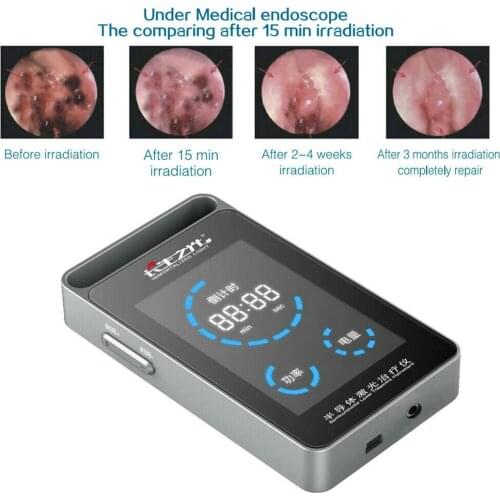 LLLT Cold 650nm Laser Therapy Device Medical Phototherapy Electric Portable 650nm Laser Allergic Rhinitis Red Light Treatment