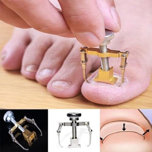 Ingrown Toe Nail correction pedicure foot toe nail care tools file Elastic Patch Straightening Clip Brace corrector Wire Fixer