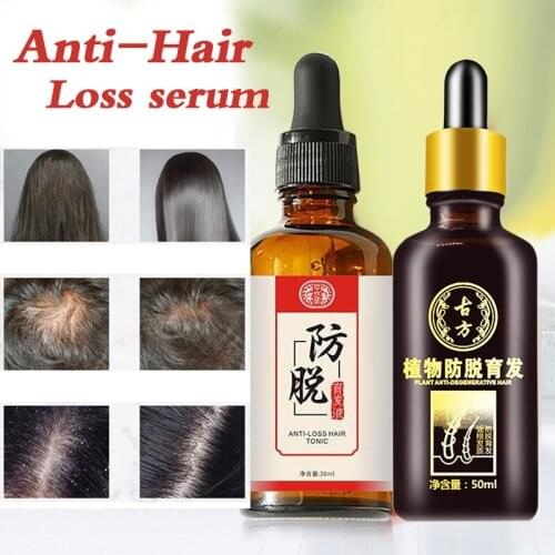 Hair growth essence oil anti-hair loss is used in hair care and beauty hair loss thick repair and damaged hair care products