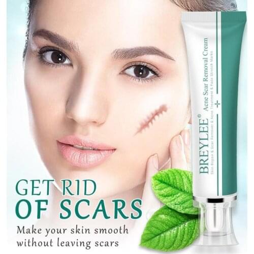 30g Skin Repair Acne Scar Removal Cream Face Cream Fades To Repair Scarsskin Care Scar Treatment Stretch Marks Whitening Cream