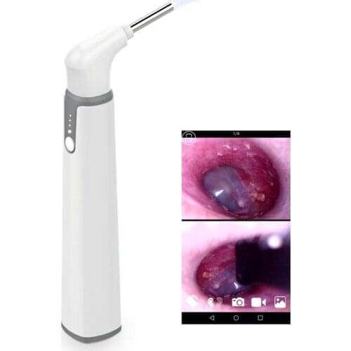 Wifi Smart Otoscope Earscope Cleaner Ear Spoon Earpick 3.9mm Endoscope Camrea