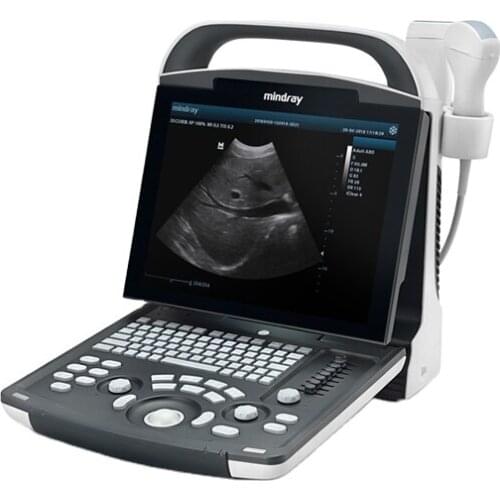 Mindray DP-10 original convex virginal linear probe portable laptop ultrasound machine