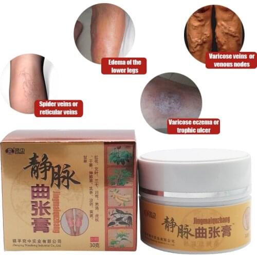 Varicose Veins Treatment Ointment Varicosity Angiitis Phlebitis Spider Cream Removal Herbal Medical Personal Health Care