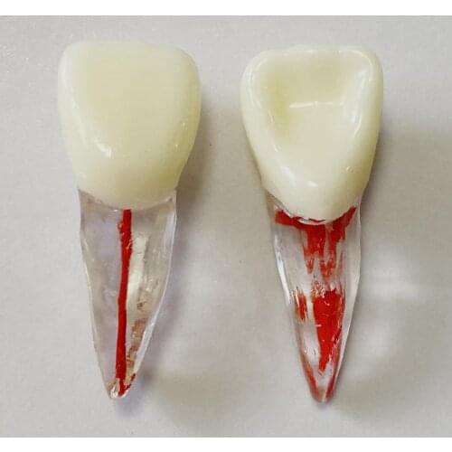 11# Front Teeth Model Dental Endo Files Practise Anterior Tooth Tool Root Canal Red Pulp Upper