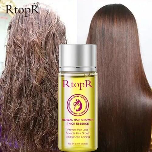 RtopR Fast Hair Growth Essential Oil Herbal Medicine Prevent Hair Loss Repair Dry Frizz Damaged Hair Serum Essence Products 20ML