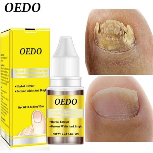Herbal Remove Nail Fungus Serum Feet Care Treatment Antiseptic Nail Fungal Anti Infection Paronychia Onychomycosis Essence 10ml