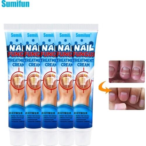 5pcs Sumifun Nail Care Nail Repair Cream Fungal Nail Treatment Cream Antibacterial Repair Ointment Whitening Toe Anti Infection