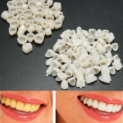 Lemecima Veneers