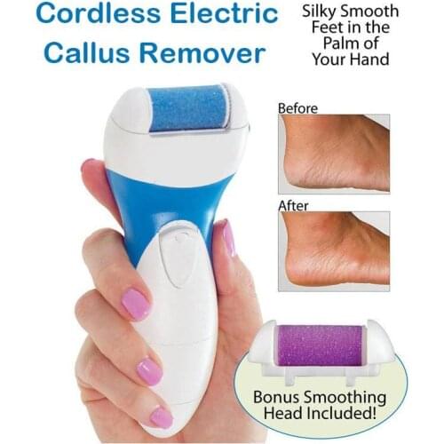 Cordless Electric Callus Remover