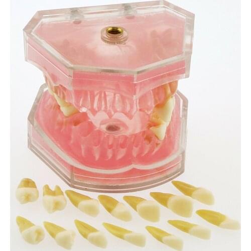 Dental Removable Study Teach Model 28 Pcs Teeth Standard Adult Teeth Model