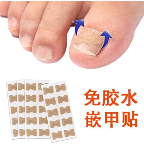 10Pcs/lot Toenail Corrector Ingrown Toe Foot Nail Correction Patch Nail Sticker