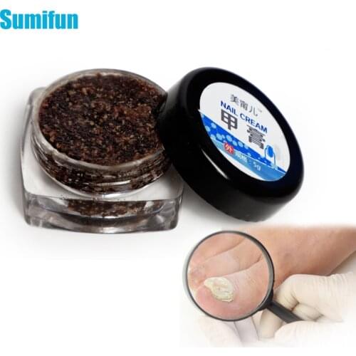 1pcs Anti-Fungal Cream Nail Treatment Pen Onychomycosis Anti Infection Paronychia Chinese Herbal Care Medicinal Ointment P0086