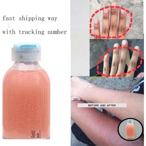 Strong Hand and Feet Lightening Whitening Cleansing Serum To Clean Up Dark Knuckles Melting and brightening the skin 30ml