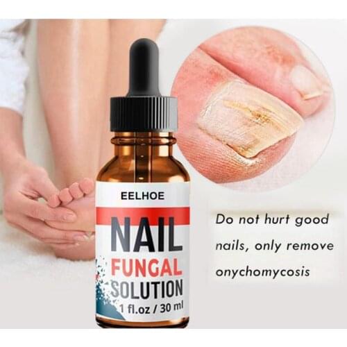 30ml Nail Repair Serum Essences Fungal Care Treatments Foot Nail Fungus Removal Gel Anti-infective Paronychia Onychomycosis
