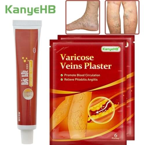 12pcs Patches+1pcs Ointment Varicose Veins Treatment Varicosity Angiitis Removal Vasculitis Phlebitis Spider Leg Pain Plaster