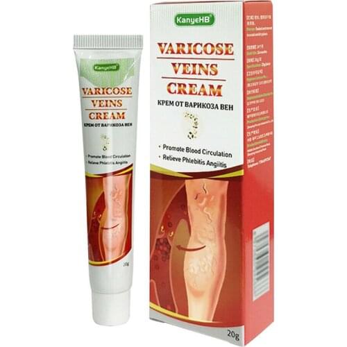 20g Vasculitis Phlebitis Gel Pain Relief Varicose Veins Ointment Cream Varicosity Angiitis Removal Herbal Medical Plaster