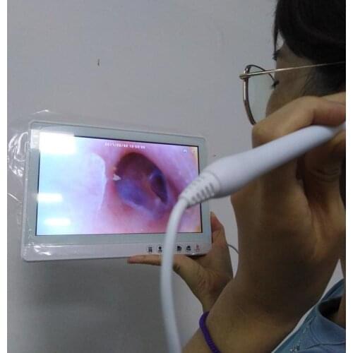 Video Otoscope for Pet People with 10.1inches Screen Usb Endosocpe Camera